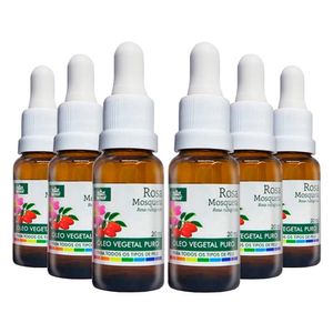Kit 6x Óleo Vegetal Rosa Mosqueta 20ml - Wnf
